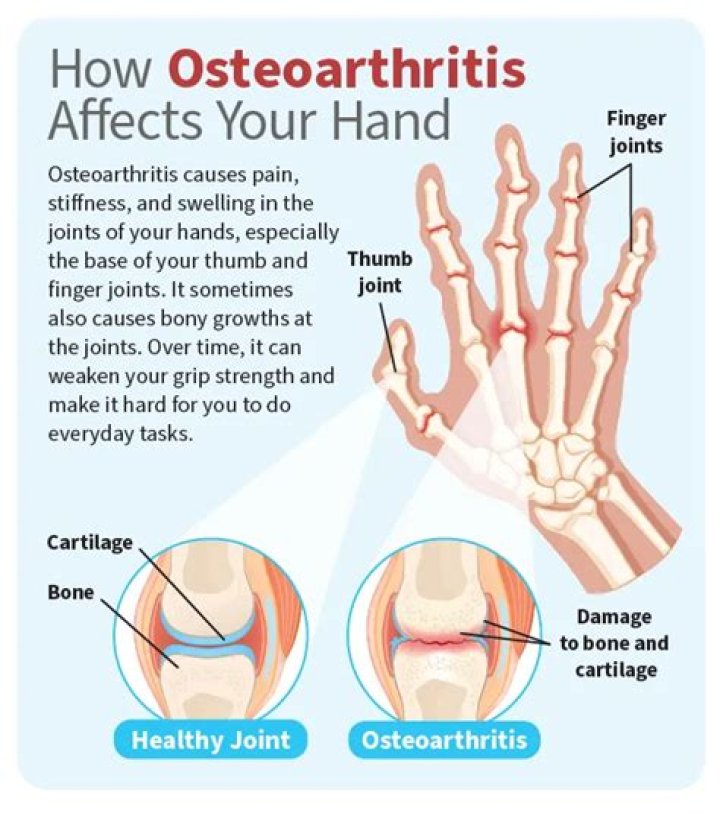 What causes deforming arthritis?