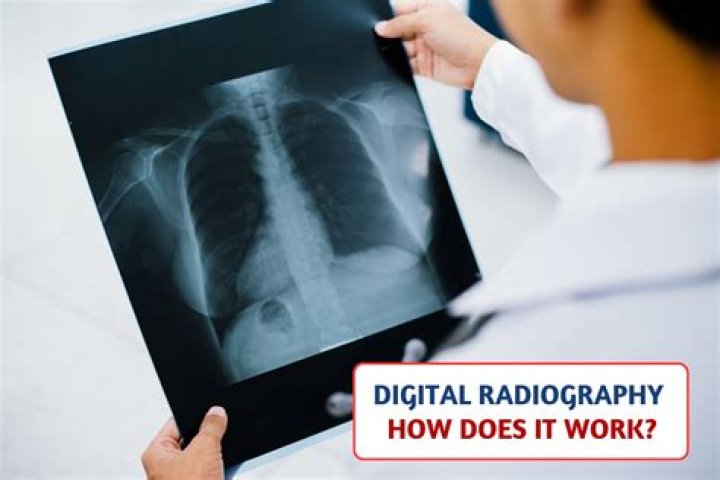 What is safelight in radiography?